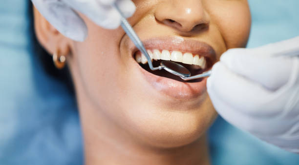 Best Emergency Treatment for Oral Infections in Dayton, OH